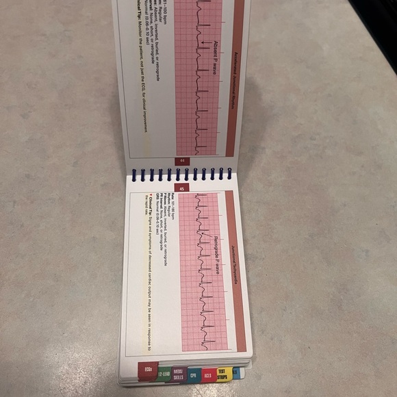 ECG interpretation & management guide. Provides the basics to ACLS - Picture 13 of 16